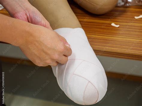 Foto De Orthopedic Surgeon Demonstrates Stump Elastic Bandaging On A