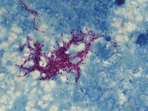 Ziehl Neelsen Staining