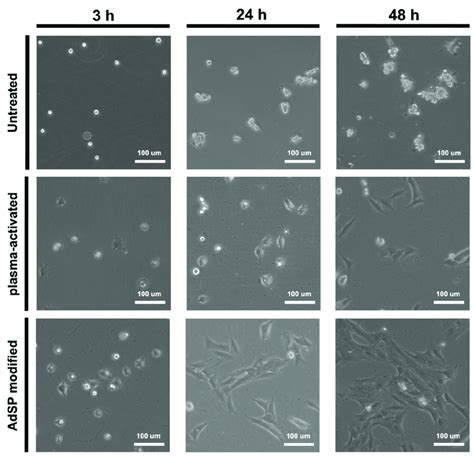 Cell Adhesion Behavior Of NSCs Within 48 H On The Untreated