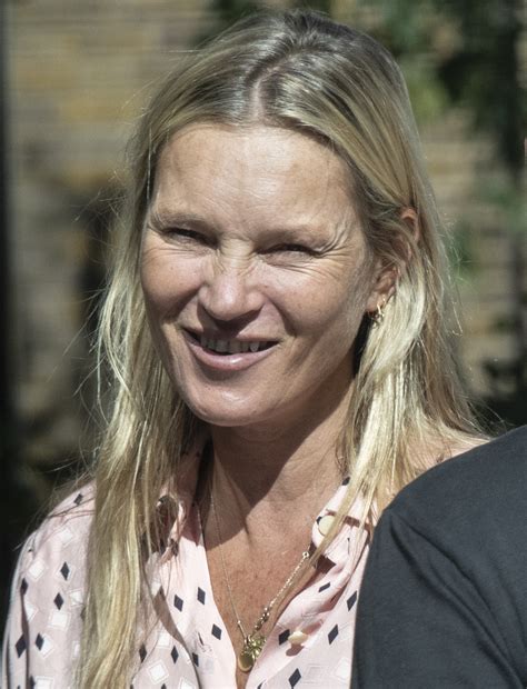 Kate Moss Teeth Drugs