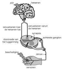 Sensitisatie Bij Chronische Pijn Chronische Pijn Sensitisatie
