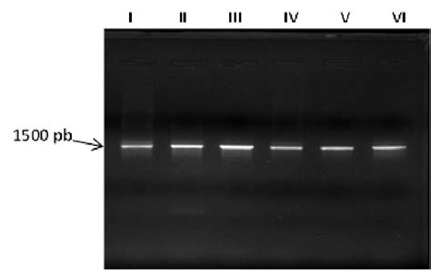 Pcr Gel Electrophoresis Showing 16s Rrna Gene Bands At 1500pb Of The