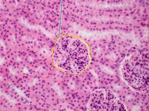 Epithelial Tissue Flashcards Quizlet