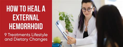 How to Shrink External Hemorrhoids Quickly (12 Ways)