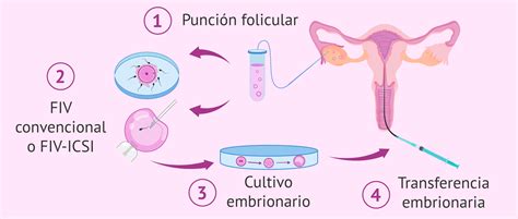 ¿qué Es La Fecundación In Vitro Fiv Proceso Y Precio