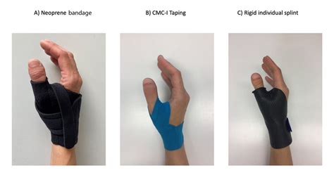 Different splints of the TMC joint. The right splint has to be chosen ...