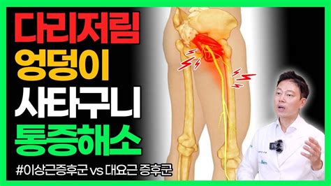 엉덩이통증 다리저림 허리통증 허벅지통증 이 스트레칭 마사지 하시면 싹 없어지고 편해집니다 좌골신경통 이상근증후군