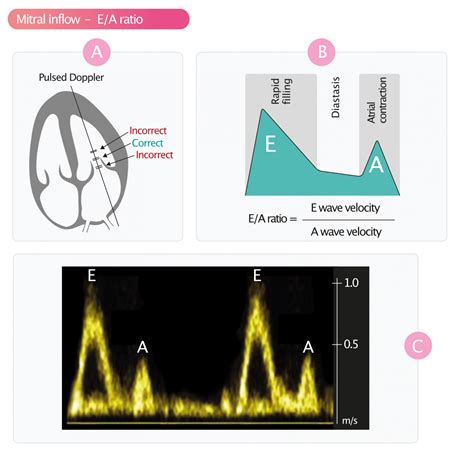 Assessment Of Diastolic Function By Echocardiography Cardiovascular