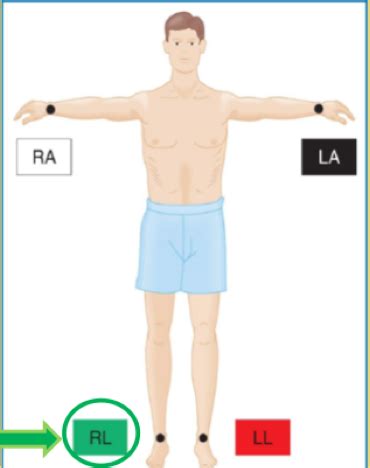 Acs Flashcards Quizlet