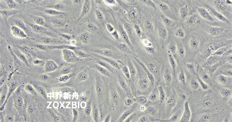 HUVEC细胞 人脐静脉内皮细胞 原代细胞 中乔新舟