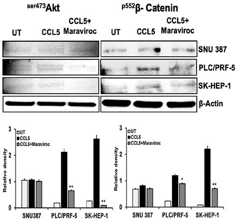 The Ccl5 Ccr5 Interaction Mediates Cell Survival And The Epithelial To