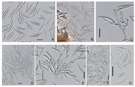 Microorganisms Free Full Text Evidence Of Microdochium Fungi