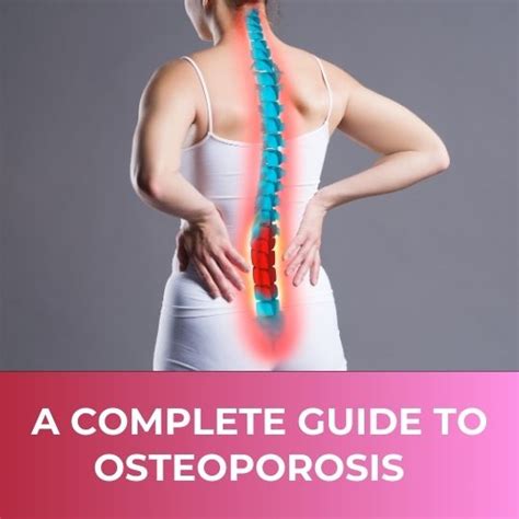 The Ultimate Guides To Osteoporosis Articles Expert Advice Tips And Information