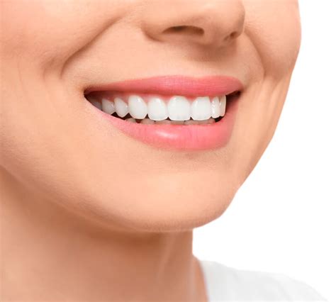 Dúvidas frequentes sobre clareamento dental Confira