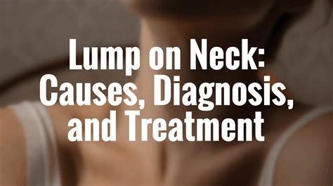 Lump on Neck: Causes, Diagnosis, and Treatment