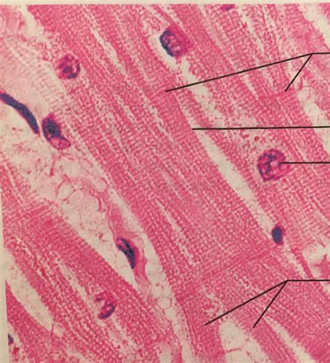 Photomicrograph of cardiac muscle Diagram | Quizlet