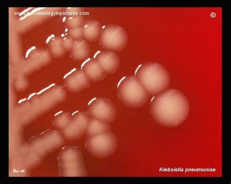 Klebsiella Pneumoniae On Blood Agar