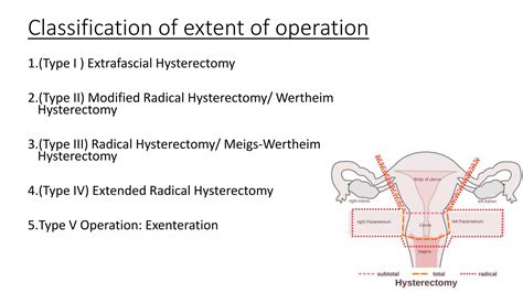 Surgical Management Of Carcinoma Cervix PPT