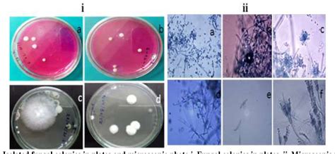 Figure From Isolation Of Soil Fungi And Screening Of In Vitro