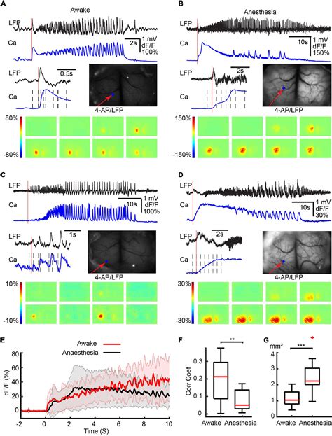 Frontiers Mesoscopic Mapping Of Ictal Neurovascular Coupling In Awake