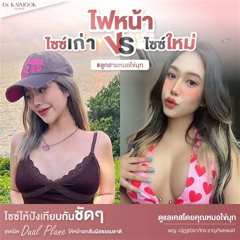 ไฟหน้าไซซ์เก่า Vs ไซซ์ใหม่ เทียบชัดๆ แกลเลอรีที่โพสต์โดย Dr Kaimook Lemon8