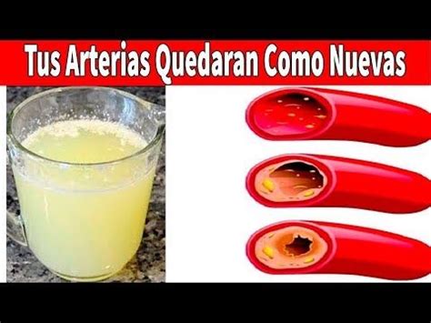 Destapa Tus Arterias Con Solo 1 Vaso De Este Jugo Limpiar Arterias