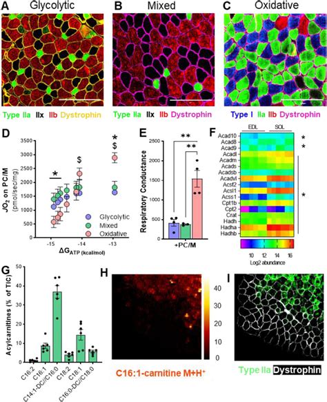 Muscle Fiber Type Composition Is A Major Determinant In Fatty