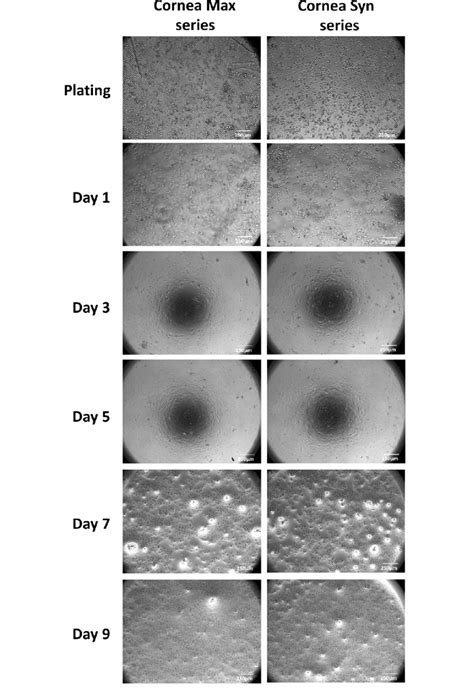 Morphology And Confluence Of Human Corneal Endothelial Cells Cultured