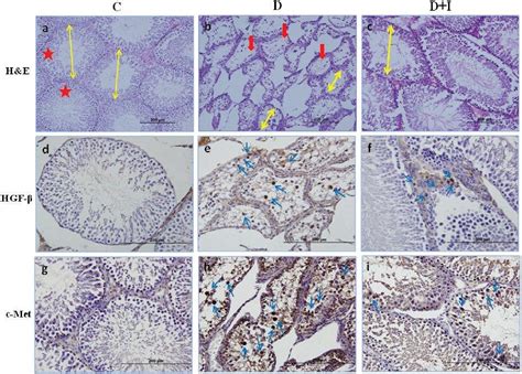 Figure 1 From HGF C MET PATHWAY HAS A ROLE IN TESTICULAR DAMAGE IN