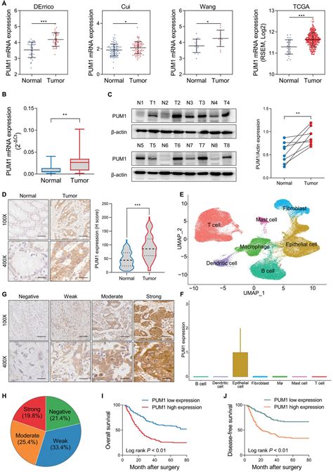 Pum Promotes Tumor Progression By Activating Deptormeditated