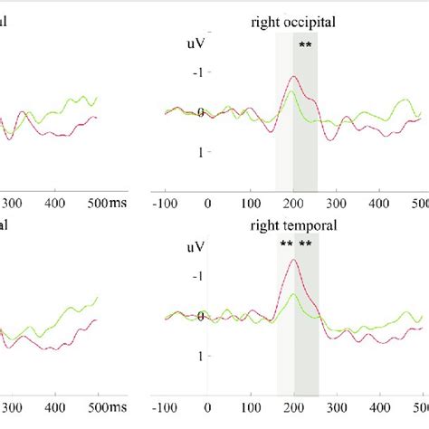 The Erp Responses To Deviant Minus Standard Differential Vmmn