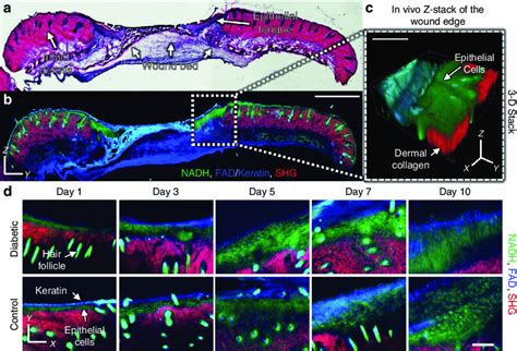 Comparison Of In Vivo Mpm Imaging At The Wound Edge With Ex Vivo Tissue