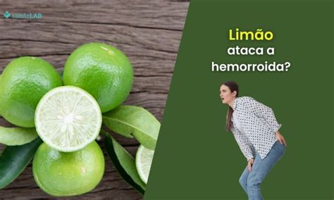 O Que Faz Mal Para Hemorroida - Limão faz mal para hemorroida? Entenda seus efeitos no problema de saúde