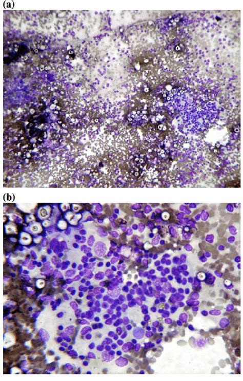 A B Cytological Smears 109 And 409 View Stained With Mgg Stain Showing Download Scientific