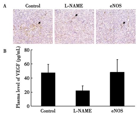 VEGF concentration in plasma and the VEGF鄄 VEGFR 2 complex in tumor