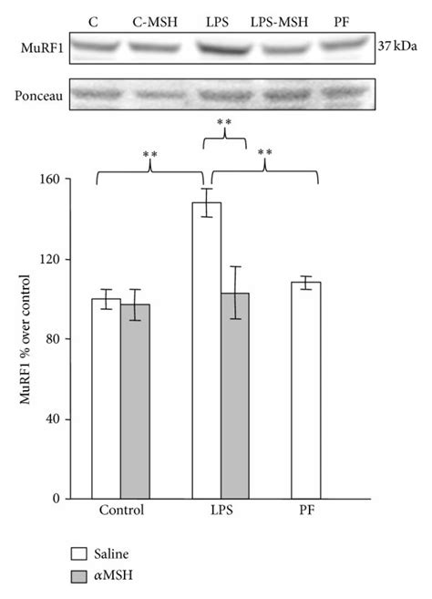 Atrogin 1 MRNA A MuRF1 MRNA B And MuRF1 C In Gastrocnemius