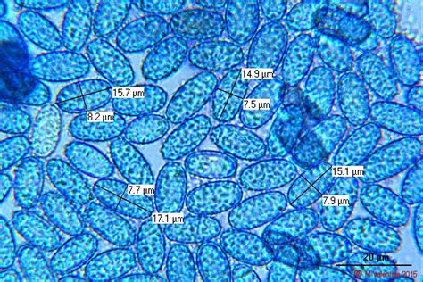 Peziza Under Microscope Labeled