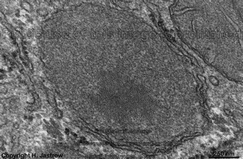 Peroxisomes Drjastrows Em Atlas