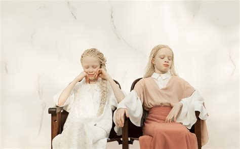 Meet the enchanting 11-year-old albino twins for a Double the Adventure