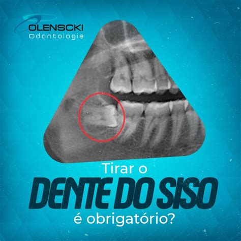 É Obrigatório Tirar O Siso - Tirar o dente do siso é obrigatório – Olenscki Odontologia