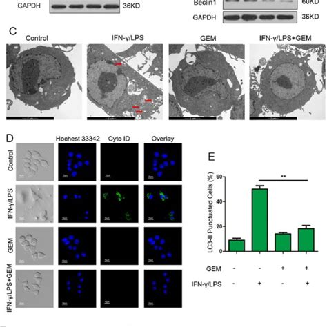 The Role Of Autophagy In Gem Induced Immune Inhibition In Raw