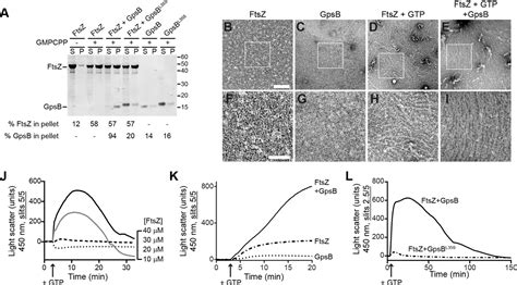 An Essential Staphylococcus Aureus Cell Division Protein Directly