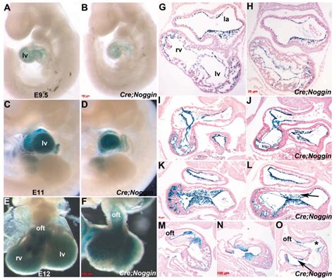 Ectopic Noggin In A Population Of Nfatc1 Lineage Endocardial