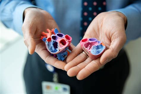 How D Printer Heart Technology Changed A Teens Life Uc San Francisco