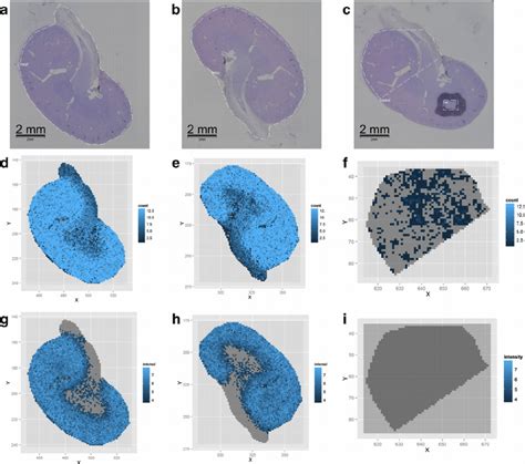 Maldi Imaging Ms Of N Linked Glycans Released From Formalin Fixed Download Scientific Diagram