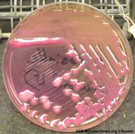 EX2 Chapter 19 Enterobacteriaceae E Coli Salmonella Shigella