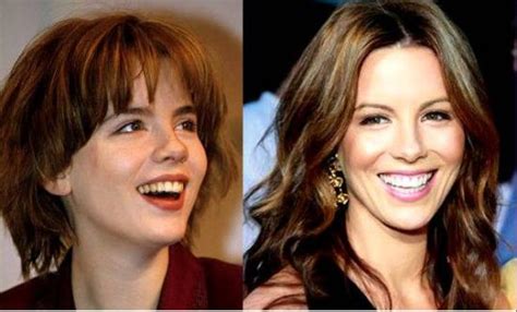 Kate Beckinsale Plastic Surgery - An Amazing Cosmetic Procedure