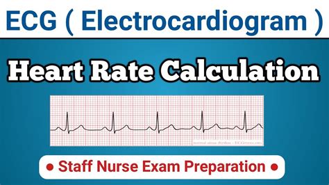 Heart Rate Calculation By Ecg Stripes Ecg Part 5 Youtube