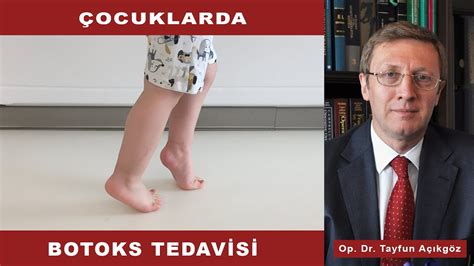 Ocuklarda Botoks Tedavisi Op Dr Tayfun A Ikg Z Youtube