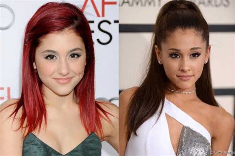 Ariana Grande Plastic Surgery: face modification,lose weight,rhinoplasty